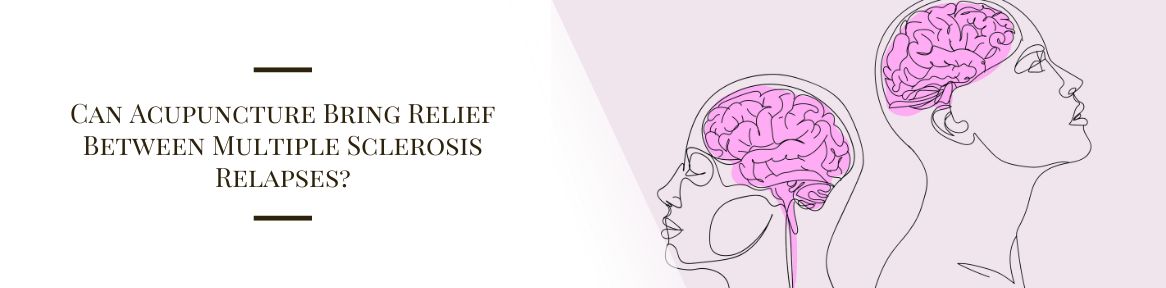 Can Acupuncture Bring Relief Between Multiple Sclerosis Relapses?
